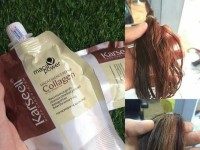 Top 15 kem trị mụn thâm, mụn mủ, mụn trứng cá tốt nhất hiện nay 2021